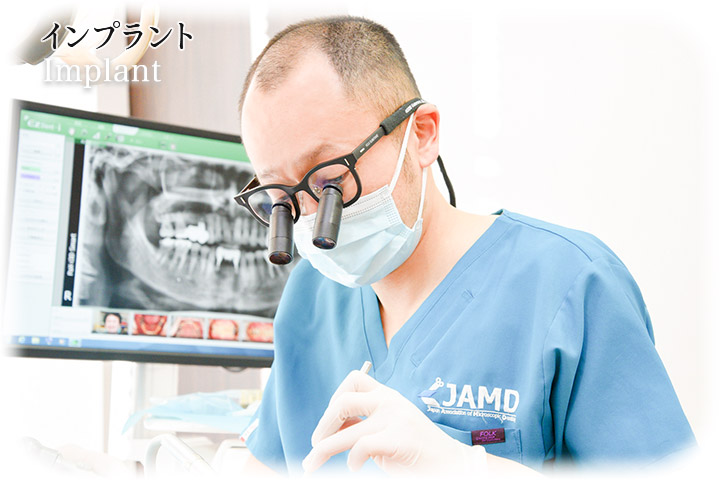 歯科口腔外科 | Implant